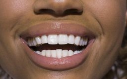 Jupiterimages/Pixland/Getty Images Las ideas de negocios de blanqueamiento de dientes pueden ayudar a los clientes a lograr una sonrisa mas brillante.
