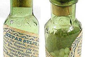 Los médicos homeopáticos podrían eliminar las causas de la dermatosis purpúrica pigmentada.