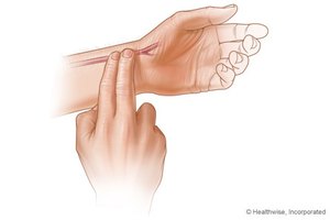 Tu pulso de recuperación mide la capacidad de tu corazón para recuperar sus funciones normales después del ejercicio intenso.