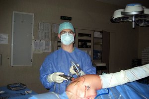 La cirugía de hombro artroscópica se realiza típicamente en las lesiones del manguito de los rotadores, tales como la tendinitis y los desgarres, algunos de los cuales pueden ser graves.