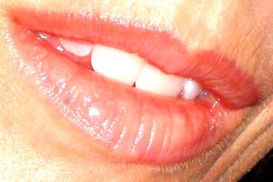 Consulta a tu médico sobre cualquier enfermedad de la piel que esté acompañada de fiebre o que parezca estar extendiéndose.