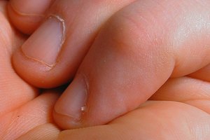 Para prevenir padrastros, usa crema hidratante sobre las manos, dedos y cutículas.