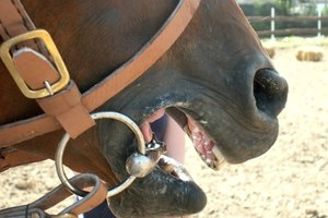 La enfermedad de Cushing afecta el sistema endocrino.