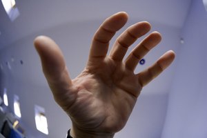 Hay muchas de piezas móviles en la mano y esto puede dar lugar a confusión y a lesiones complejas.