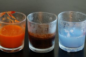 Hepatitis alcohólica.