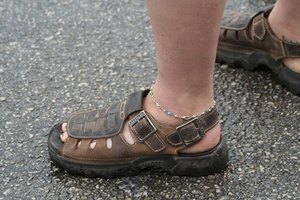 Vestir sandalias puede ayudar a reducir el sudor excesivo en los pies.