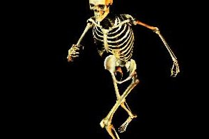 La causa más común es una patología denominada costocondritis.