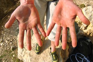 El colágeno y la vitamina B3 reducen las ampollas.