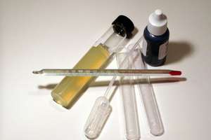Los exámenes de sangre informan sobre el nivel de potasio.