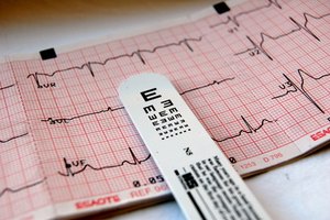 Conocer tu ritmo cardiaco normal ayuda a detectar nuevos problemas.