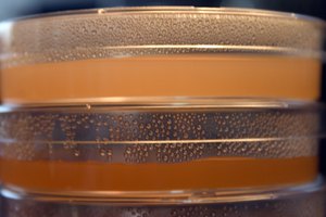 A menudo se realizan cultivos en el laboratorio para confirmar el diagnóstico de una infección bacteriana.