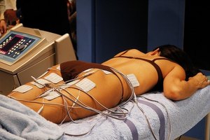 La celulitis infecciosa es causada por una infección bacteriana.