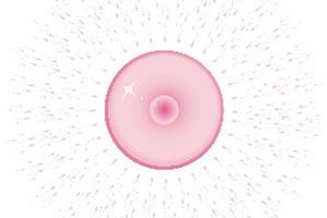 Mirena altera los niveles hormonales de la mujer.