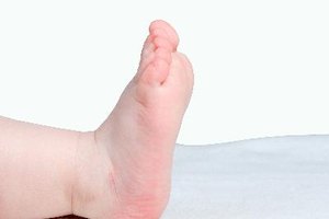 BabiesToday.com advierte a los padres que no deben usar ninguna medicación en el recién nacido, a menos que lo ordene un médico.