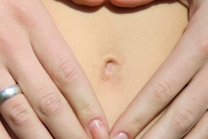 En un caso típico, un paciente tendrá dolor cerca del ombligo.