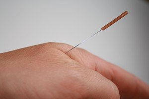 La acupuntura consiste en la inserción de pequeñas agujas en diferentes puntos del cuerpo.