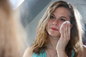 Cuida bien tu rostro después de un tratamiento con TCA para garantizar que la experiencia tenga buenos resultados.
