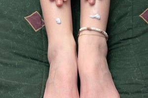 Aplicar loción en tus piernas después de afeitarlas podría ayudar a aliviar los vellos encarnados.