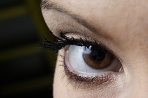 Los vasos sanguíneos rotos en los ojos pueden resultar por numerosas causas.