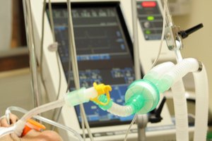 Los pacientes con ELA suelen agotar la respiración y alimentarse con máquinas.