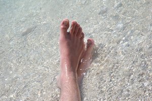Curas para uñas en las uñas de los pies.