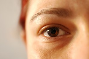 La mucosidad excesiva puede afectar a los ojos.