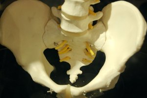 El fortalecimiento de los músculos pequeños de la pelvis y las caderas pueden ser útiles para que puedas moverte con mayor eficiencia.