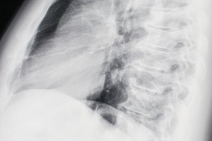 Pruebas para tumores cancerosos.