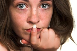Las pecas: cortesía del sol.