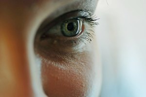 La piel oscura y seca alrededor de los ojos se puede eliminar con remedios naturales.