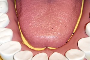 El hormigueo de la boca y ardor son signos comúnes de una alergia alimentaria.