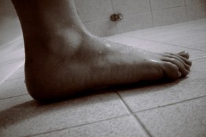 Cómo corregir un desgarro de la fascia plantar.
