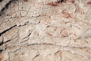 El omega-3 mejora los síntomas de psoriasis.