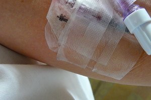 Quimioterapia vesicante.