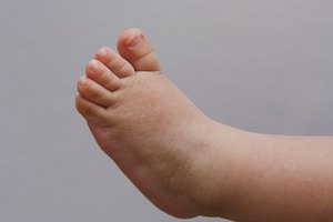 ¿Cómo se produce un esguince en el pie?