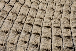 La psoriasis se presenta como parches rojos en la piel.