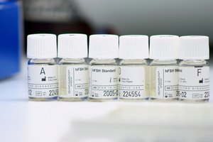 Conoce los efectos secundarios de tomar melatonina.