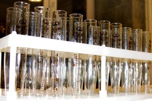 Varios resultados de las pruebas de laboratorio son anormales en pacientes con artritis reumatoide.