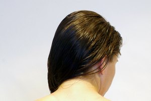 Prueba una variedad de tratamientos para eliminar las espinillas en la espalda.