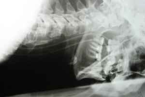 La glándula tiroides está localizada en la parte de tu cuello.
