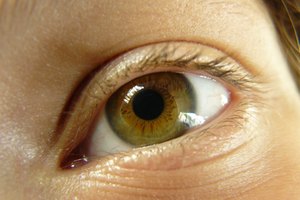 ¿Cuánto dura una cirugía de cataratas?