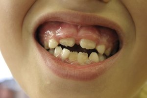Esta condición puede poner en riesgo la vida