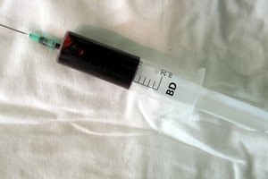 El cuerpo mantiene su pH entre 7,35 y 7,45.