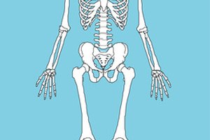 Una inyección anual puede ayudar a fortalecer los huesos débiles de la osteoporosis.