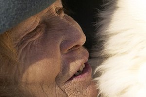 Los años de exposición al sol y las repetidas expresiones faciales pueden llevar a la formación de arrugas profundas.