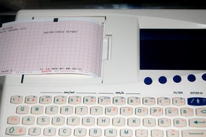 Ritmo cardíaco.