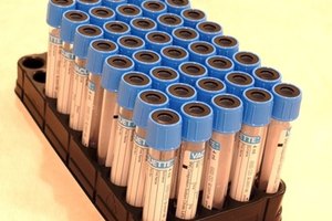 Los estudios in vitro sugieren un posible papel de la piel de almendra en el tratamiento del herpes.