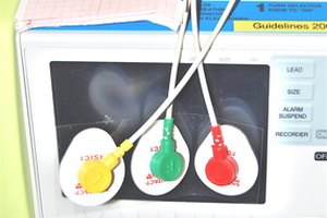 Las enfermeras preparan el equipo asegurándose de que esté montado y funcionando correctamente antes de su uso en el paciente