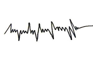 El corazón necesita una cantidad suficiente de magnesio para continuar latiendo.