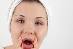 Si te lavas la cara con un limpiador y un exfoliante ligero puedes ayudar a prevenir que se multipliquen sin control.